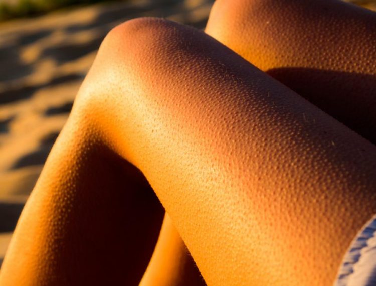 ¿Sabías que la piel de gallina es causada por un músculo?